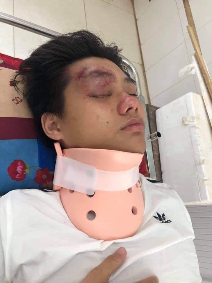 Nam sinh bị 7 thanh niên đánh hội đồng, hành hung dã man vì 1 câu nói trên FB Nam sinh bị 7 thanh niên đánh hội đồng, hành hung dã man vì 1 câu nói trên FB