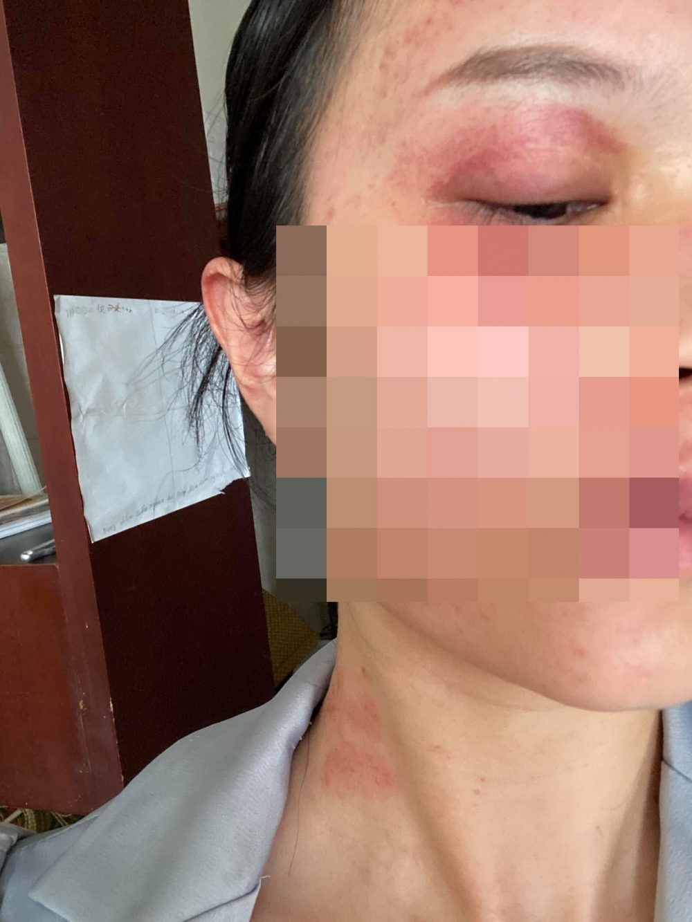 Không đồng ý ly hôn, chồng vũ phu đánh đập vợ Không đồng ý ly hôn, chồng vũ phu đánh đập vợ