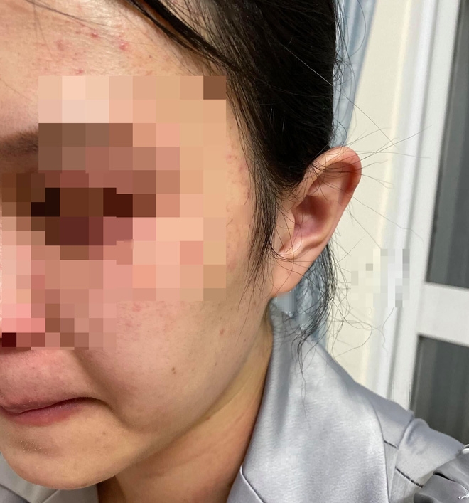 Không đồng ý ly hôn, chồng vũ phu đánh đập vợ Không đồng ý ly hôn, chồng vũ phu đánh đập vợ
