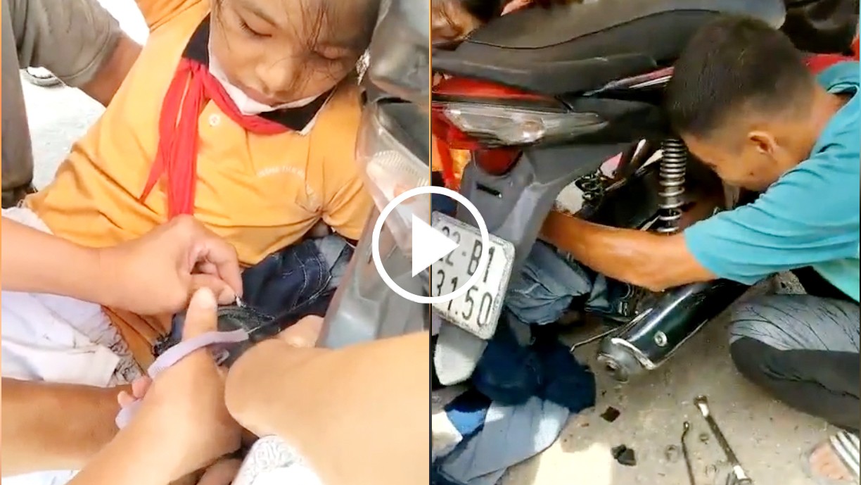 Người dân cùng nhau giải cứu bé gái bị cuốn vào bánh xe máy do vướng áo chống nắng Người dân cùng nhau giải cứu bé gái bị cuốn vào bánh xe máy do vướng áo chống nắng
