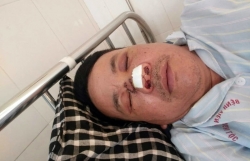 2 doi tuong cau trom cho bi dan lang vay danh dot xe o nghe an