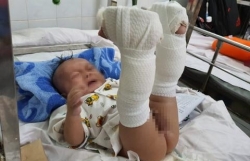 nguoi dan ong tum toc danh da man phu nu trong thang may khai gi