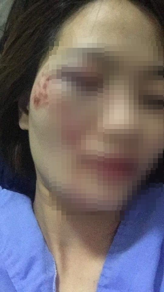 Nhắc nhở hành khách, nữ nhân viên xe buýt bị 4 thanh niên hành hung đúng ngày 20/10 nhac nho hanh khach nu nhan vien xe buyt bi 4 thanh nien hanh hung dung ngay 2010