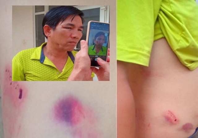 Vì sao Chánh văn phòng Huyện ủy đánh lái xe nhập viện không bị khởi tố? vi sao chanh van phong huyen uy danh lai xe nhap vien khong bi khoi to