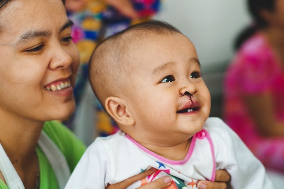 Lịch, địa chỉ đăng ký phẫu thuật miễn phí cho trẻ sứt môi, hở hàm ếch tháng 12/2019 co hoi thay doi cuoc doi cho benh nhi sut moi ho ham ech thang 122019