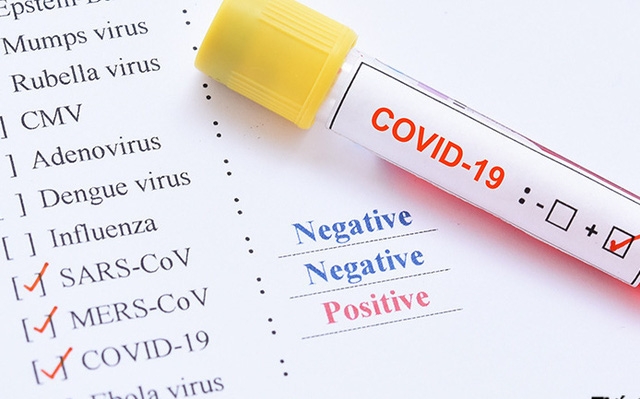 Tin tức trong ngày 3/4 mới nhất: Hà Nội vừa test nhanh Covid-19, vừa lấy mẫu xét nghiệm RT-PCR tin tuc trong ngay 34 moi nhat ha noi vua test nhanh covid 19 vua lay mau xet nghiem rt pcr