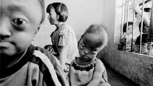 Creating Better Conditions to Support Victims of Agent Orange Creating Better Conditions to Support Victims of Agent Orange