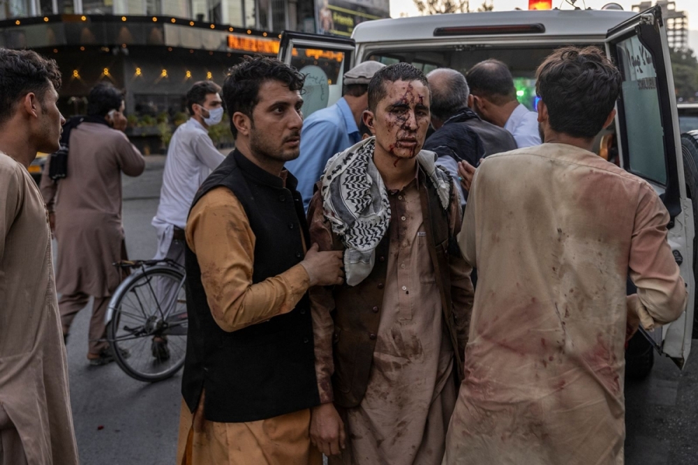 Ảnh: Kabul tang thương và hỗn loạn sau vụ đánh bom đẫm máu Ảnh: Kabul tang thương và hỗn loạn sau vụ đánh bom đẫm máu