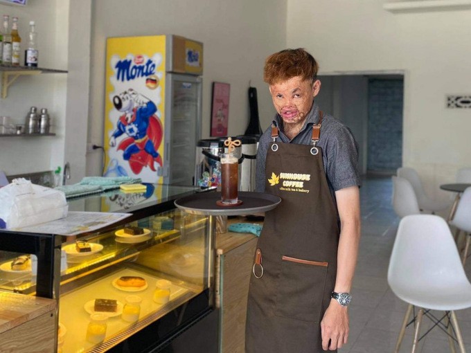 Visit Bakery & Coffee Shop of Severely Disfigured Young Man in Kon Tum Visit Bakery & Coffee Shop of Severely Disfigured Young Man in Kon Tum