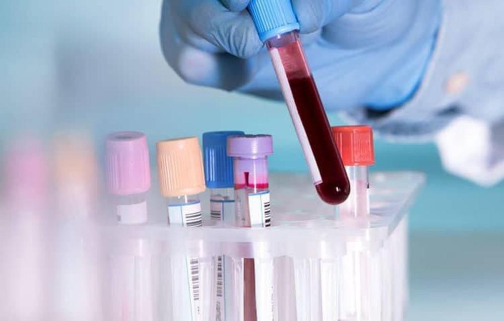 viet nam sap co test kit xet nghiem nhanh virus covid 19