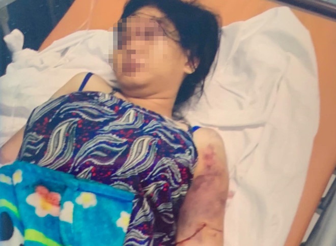khoi to bat tam giam ke danh dap da man co gai 18 tuoi say thai