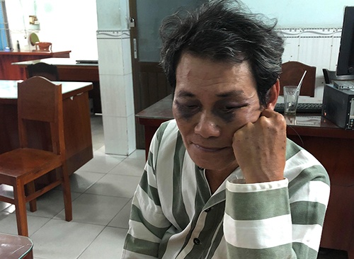 "Yêu râu xanh" bị người dân đánh bầm tím mặt vì dâm ô bé gái 7 tuổi yeu rau xanh bi nguoi dan danh bam tim mat vi dam o be gai 7 tuoi