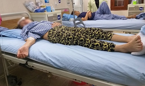 Ông già U70 vô cớ lao tới chém 2 nhát vào đầu vợ ong gia u70 vo co lao toi chem 2 nhat vao dau vo