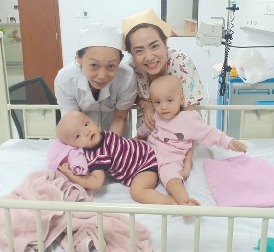 anh nhung hinh anh ve ca tach roi cap song sinh phuc tap nhat viet nam