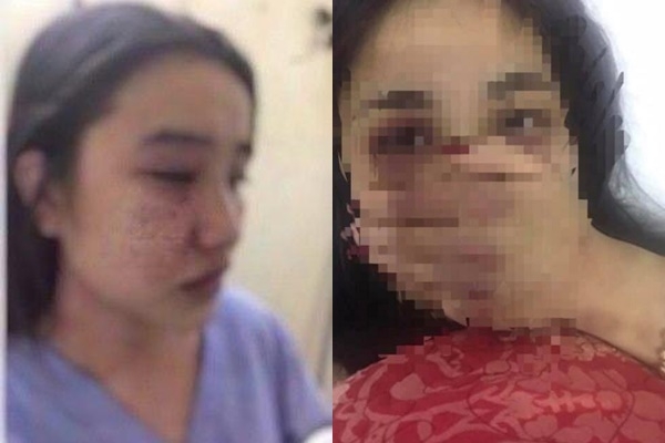 bac si nghi ga tinh danh nu thuc tap sinh nhap vien bi tam dinh chi cong tac