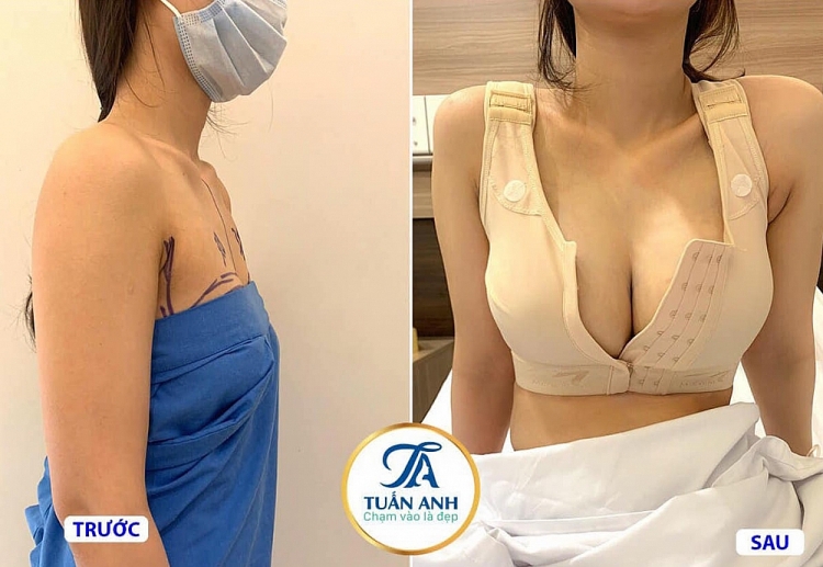 Bác sĩ Trần Tuấn Anh - “đôi bàn tay tài hoa” giúp chị em có được vòng một mơ ước Bác sĩ Trần Tuấn Anh - “đôi bàn tay tài hoa” giúp chị em có được vòng một mơ ước