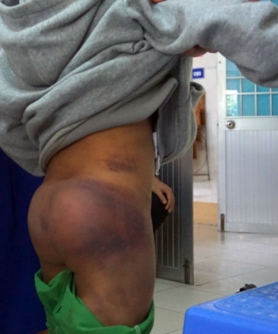 Bàn giao 4 học sinh bị người thân bạo hành cho cha mẹ ban giao 4 hoc sinh bi nguoi than bao hanh cho cha me