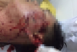 dak lak bat nhom thanh nien dot phao danh trong thuong thieu ta cong an