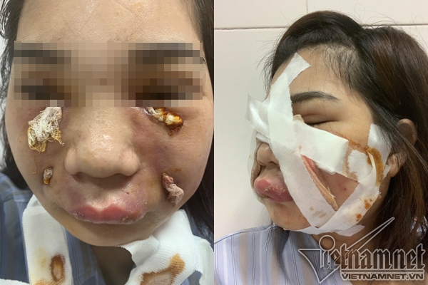 Dẹp loạn phẫu thuật thẩm mỹ: Sẽ kiếm tra đột xuất các cơ sở làm đẹp dep loan phau thuat tham my se kiem tra dot xuat cac co so lam dep