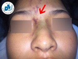 Sở Y Tế  thành phố Hồ Chí Minh tăng cường quản lý dịch vụ thẩm mỹ