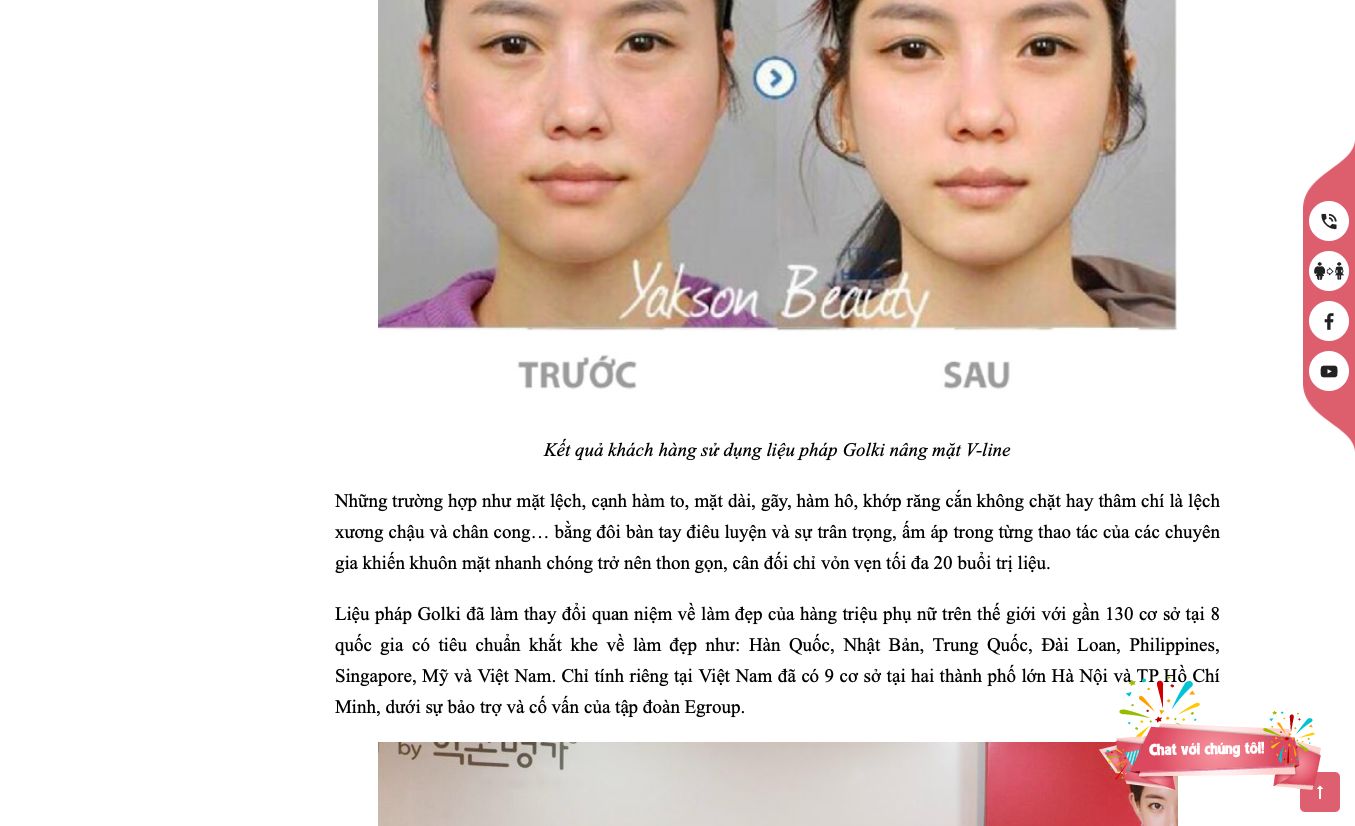 Yakson Beauty và phương pháp "nắn thẳng chân" Golki từ Hàn Quốc yakson beauty co the nan thang chan khong can phau thuat