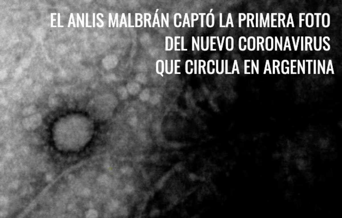 Anh sử dụng bộ xét nghiệm Covid-19 lỗi cho nhân viên y tế, Argentina chụp được hình ảnh virus lây nhiễm trong nước anh thua nhan su dung bo xet nghiem covid 19 loi cho nhan vien y te