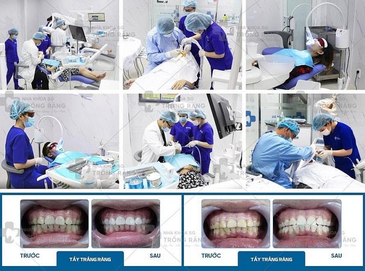 Nha khoa trồng răng Sài Gòn – Địa chỉ trồng răng uy tín, chất lượng Nha khoa trồng răng Sài Gòn – Địa chỉ trồng răng uy tín, chất lượng