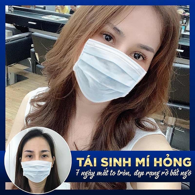 Sửa mí hỏng lấy lại “nét đẹp tâm hồn” cùng bệnh viện thẩm mỹ Gangwhoo Sửa mí hỏng lấy lại “nét đẹp tâm hồn” cùng bệnh viện thẩm mỹ Gangwhoo