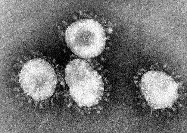 virus gay benh viem phoi la o trung quoc co the lay tu nguoi sang nguoi