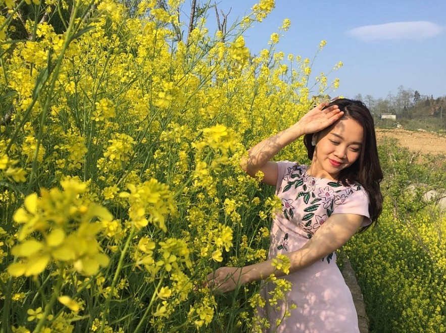 Blooming Yellow Canola Flowers In Sapa Enthral Visitors. Photo: petrotimes.vn. Blooming Yellow Canola Flowers In Sapa Enthral Visitors. Photo: petrotimes.vn.