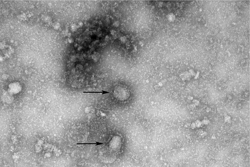 AP's report points out China delaying coronavirus outbreak's announcement aps report points out china delaying coronavirus outbreaks announcement