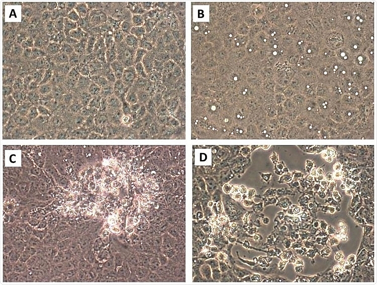 How far can air droplets can spread from person infected with coronavirus how far can air droplets can spread from person infected with coronavirus