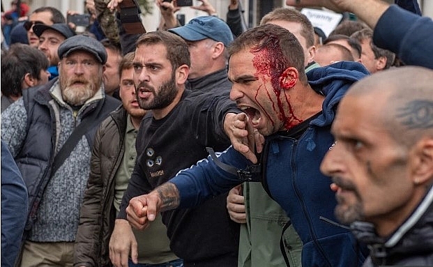 Anti-lockdown protests in the UK: Nine cops injured as Trafalgar Square and Hyde Park bombarded by thousands of maskless protesters Anti lockdown protests in the UK: Nine cops injured as Trafalgar Square and Hyde Park bombarded by thousands of maskless protesters