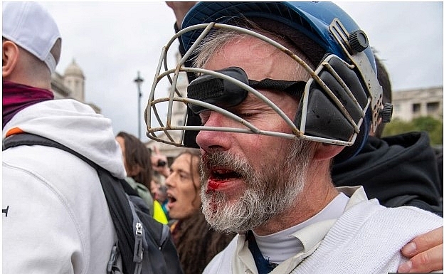 Anti-lockdown protests in the UK: Nine cops injured as Trafalgar Square and Hyde Park bombarded by thousands of maskless protesters Anti lockdown protests in the UK: Nine cops injured as Trafalgar Square and Hyde Park bombarded by thousands of maskless protesters