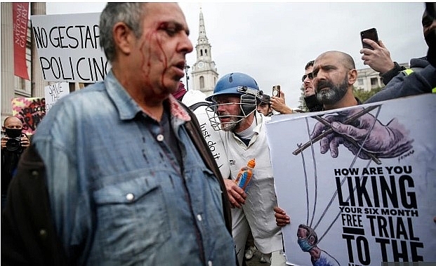 Anti-lockdown protests in the UK: Nine cops injured as Trafalgar Square and Hyde Park bombarded by thousands of maskless protesters Anti lockdown protests in the UK: Nine cops injured as Trafalgar Square and Hyde Park bombarded by thousands of maskless protesters