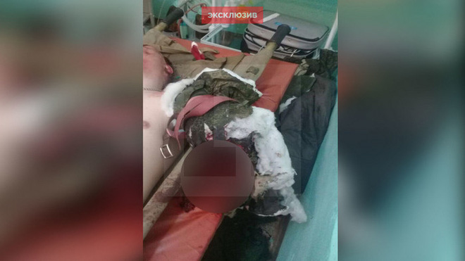 tai nan hi huu sung ak 74 no tung khi dang ban