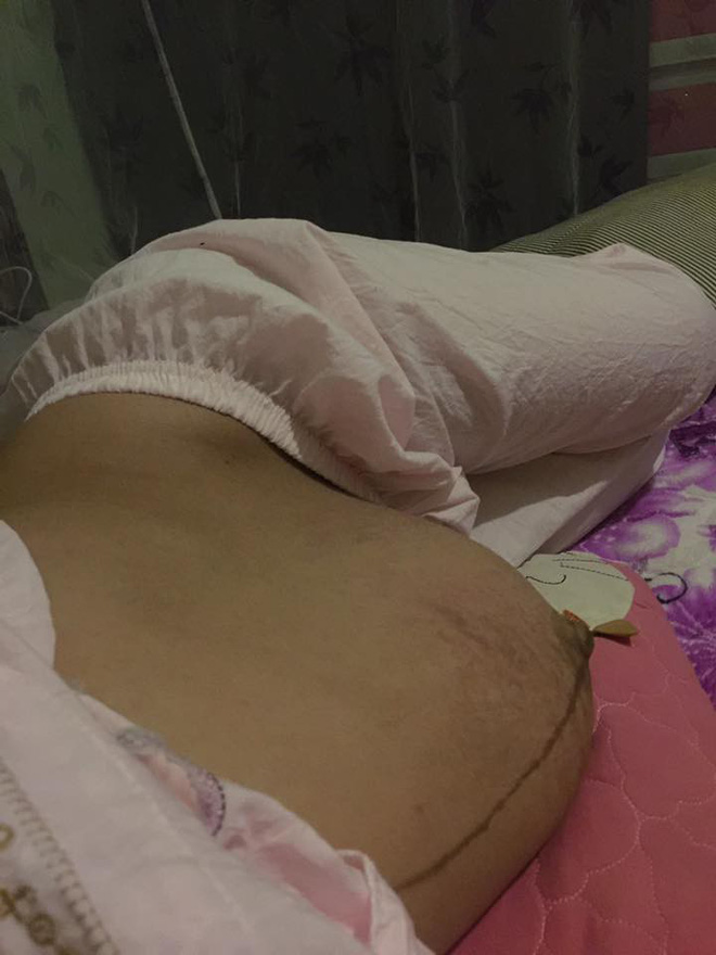 cac me ru nhau khoe bung ran beo nheo sau sinh no xem roi moi thay thuong that nhieu