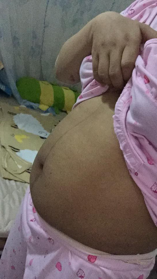 cac me ru nhau khoe bung ran beo nheo sau sinh no xem roi moi thay thuong that nhieu