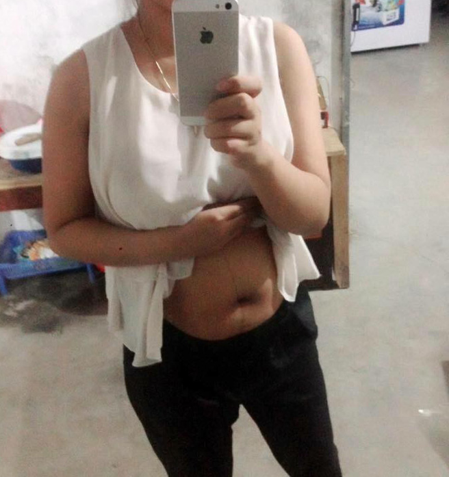 cac me ru nhau khoe bung ran beo nheo sau sinh no xem roi moi thay thuong that nhieu