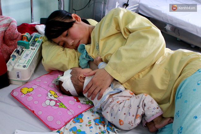 xot thuong be gai 6 thang tuoi chi nang 4kg lai phai chiu nhieu di tat tren co the