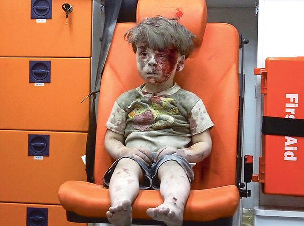 2 co be sinh doi thiet mang trong vu tan cong hoa hoc o syria hay so phan bi tham cua rat nhieu dua tre dang thuong khac