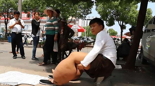 nguoi dan ong co doi chan nang 150kg chi vi mot vet muoi dot