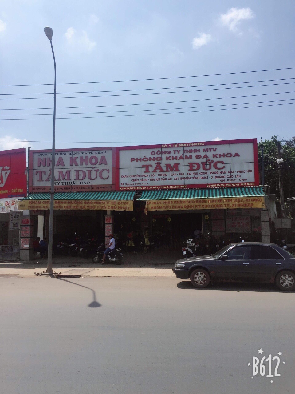 vi sao bhxh viet nam cham tra loi khieu nai cua doanh nghiep kham chua benh o binh phuoc