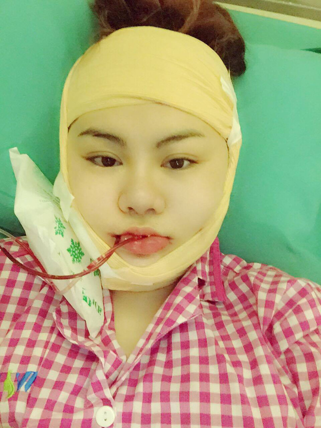 15 tuoi bat dau tham my va chi tra het 900 trieu co gai ben tre dang gay nhieu tranh cai