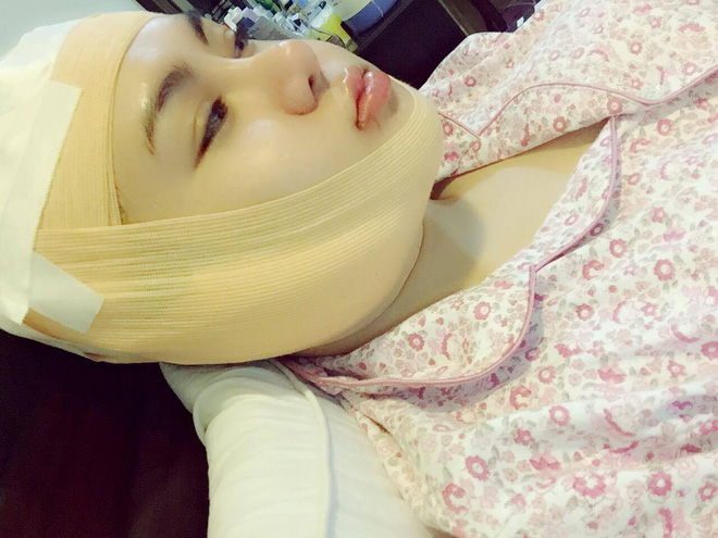 15 tuoi bat dau tham my va chi tra het 900 trieu co gai ben tre dang gay nhieu tranh cai