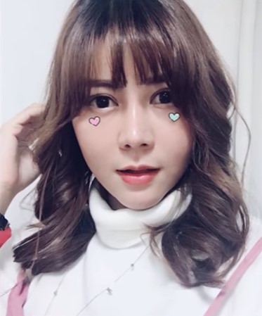 khong hai long voi ve ngoai cua minh thieu nu lot xac xinh ngat ngay sau khi chi 13 ty phau thuat tham my