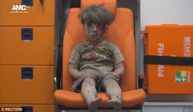 cau be syria minh day thuong tich va be bet mau sau mot nam gio the nao