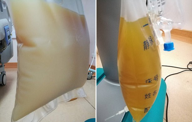 nhin cu ngo tui sua dac hoa ra lai la huyet tuong cua nguoi dan ong an qua nhieu thit