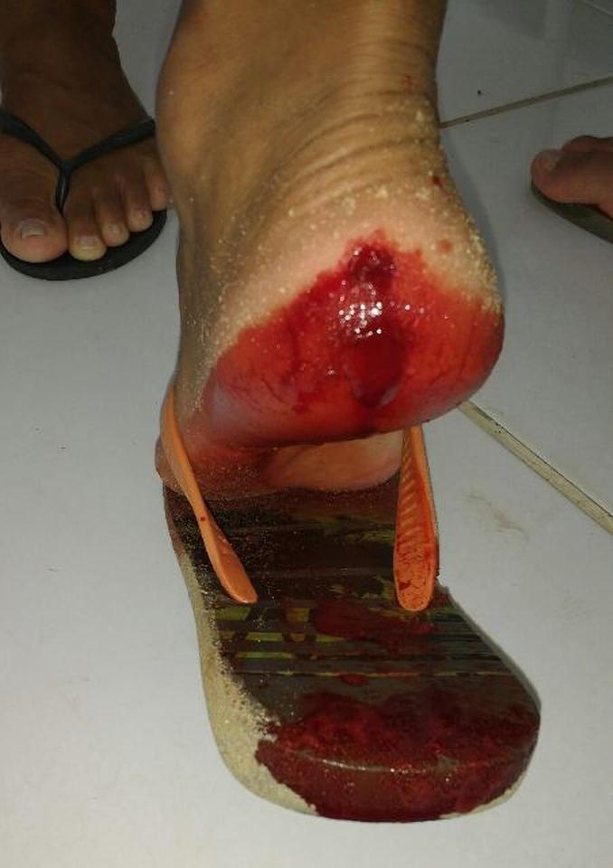 ca ho piranha tan cong du khach trong khu nghi duong o brazil