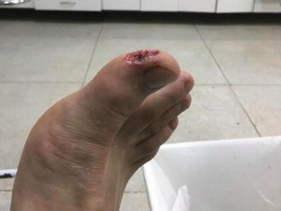 ca ho piranha tan cong du khach trong khu nghi duong o brazil
